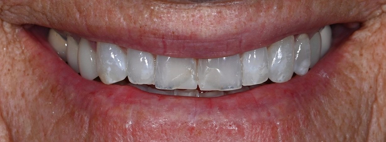Real Love Dental patient smile before treatment