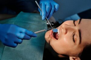The Ultimate Guide to Teeth Cleaning: Why It’s Essential for Your Smile